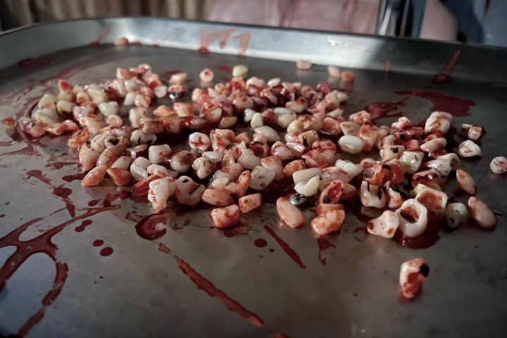 A tray with numerous small, object-like items resembling teeth covered in blood.